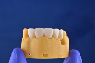 3D Printing in Dentistry: Fun and Functionality with Ackuretta Dentiq